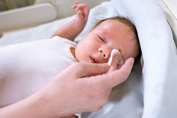 How to Cure Baby Eye Infection | StarAndDaisyCare