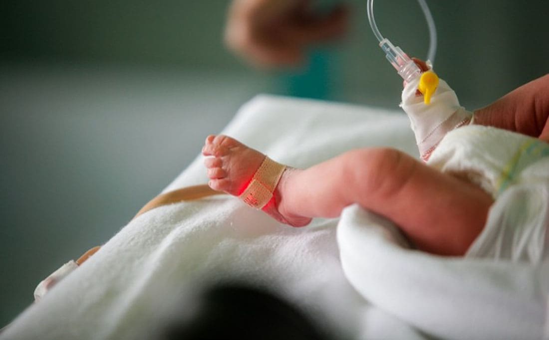 Untimely birth, gestational diabetes, stomach dying,